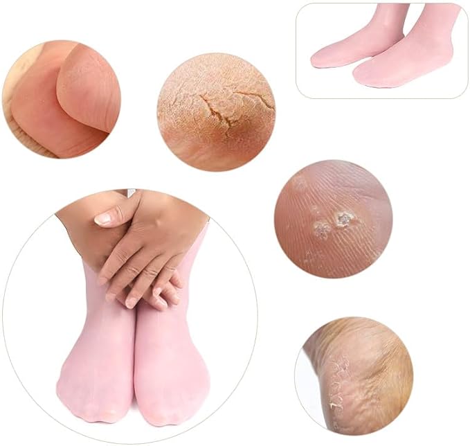 Silicon Socks Buy 1 Get 1 Free